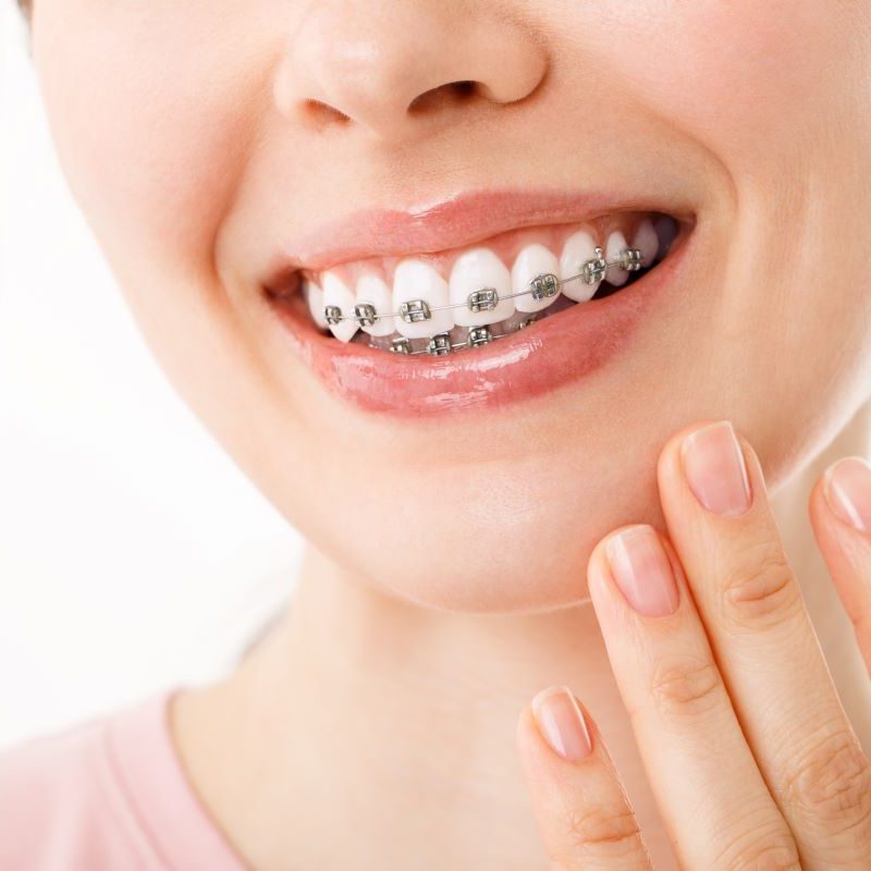 Woman with braces and a healthy smile.