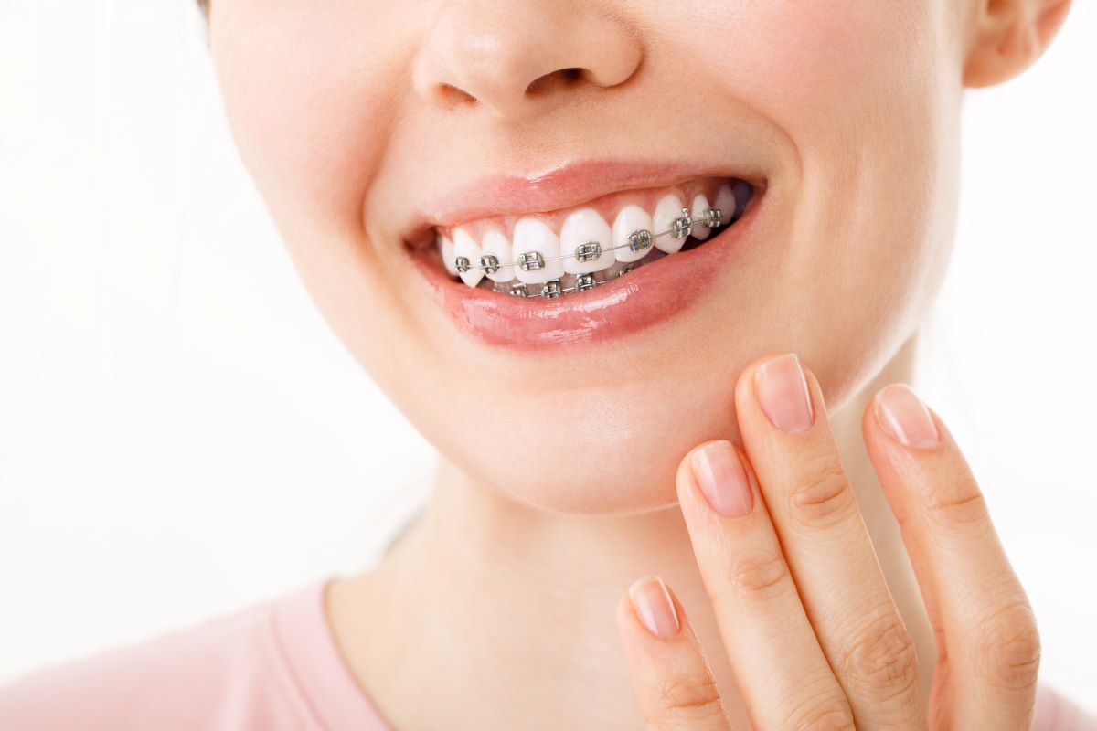 Woman with braces and a healthy smile.